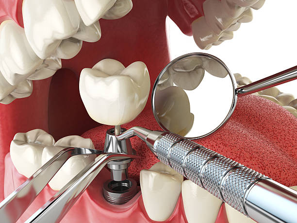 Emergency Dentist for Kids in IL